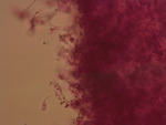 MISSING THUMBNAIL